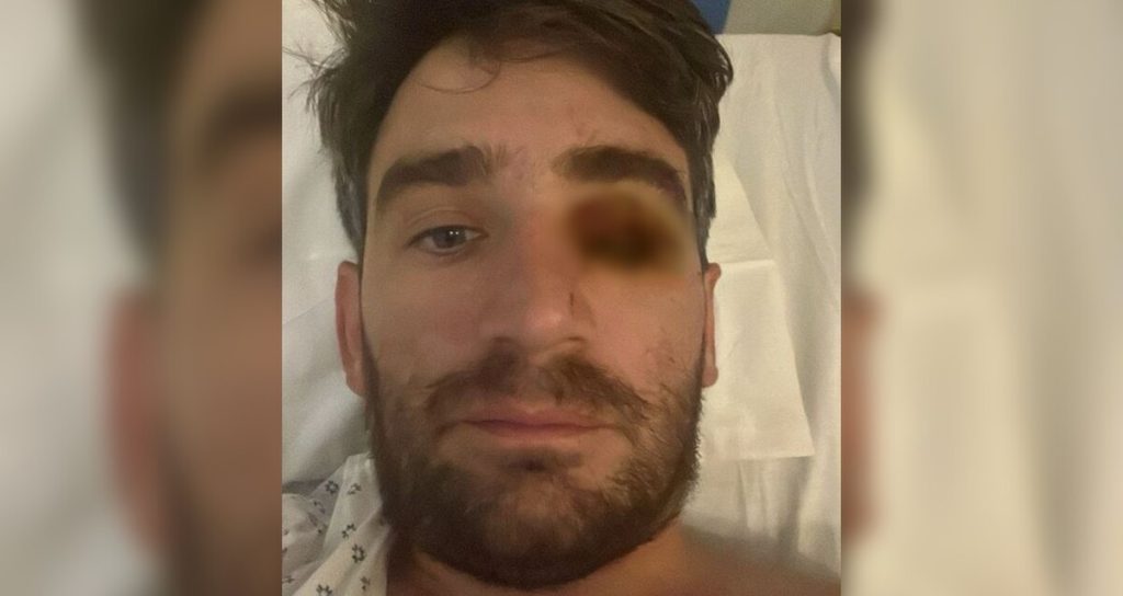 Hombre pierde un ojo en fiesta de Año Nuevo debido a explosión de pirotécnicos