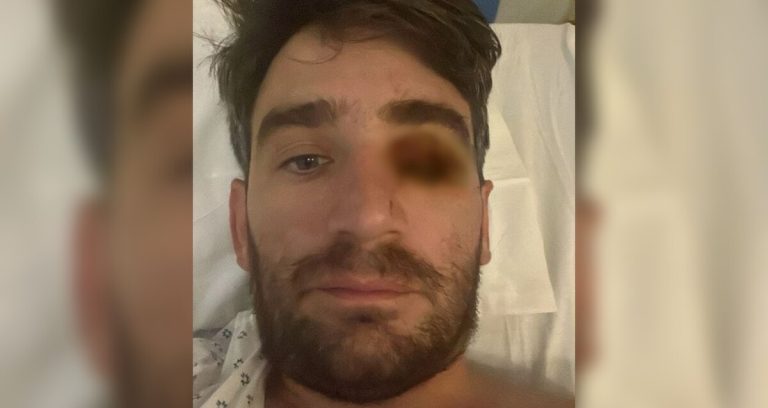 Hombre pierde un ojo en fiesta de Año Nuevo debido a explosión de pirotécnicos