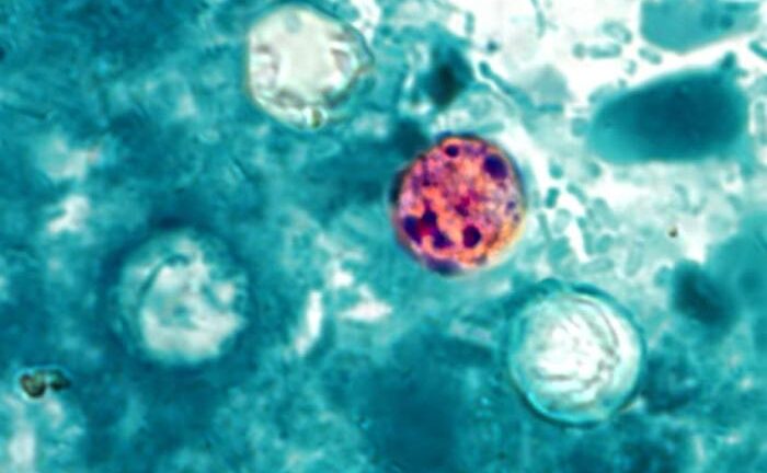 México confirma tres casos de ciclosporiasis mientras investiga el brote en EE. UU.