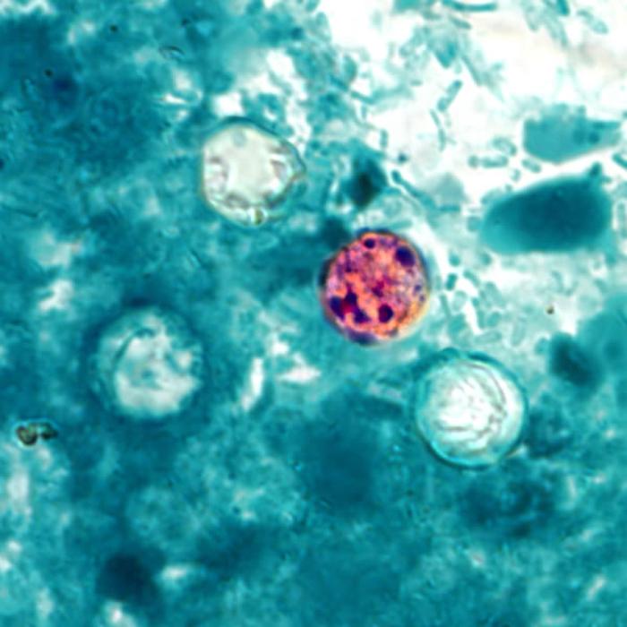 México confirma tres casos de ciclosporiasis mientras investiga el brote en EE. UU.